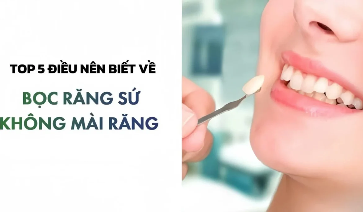 bọc răng sứ không mài