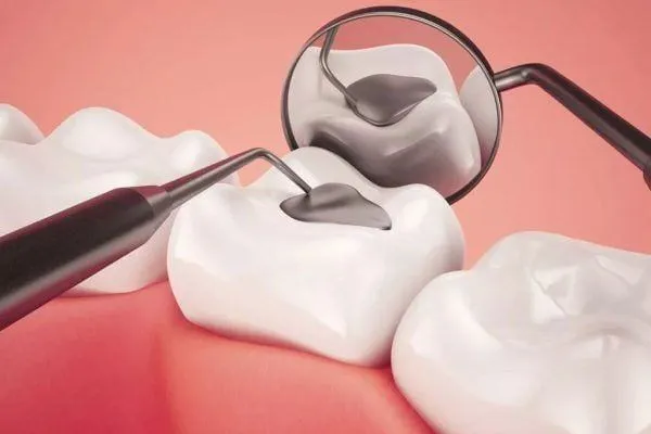 tram-rang-tham-my-hai-phong-1