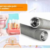 implant dio hàn quốc có tốt không